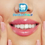 فیسینگ دندان برای لبخند بازیگران؛ راز زیبایی بی‌نقص و اعتماد به نفس