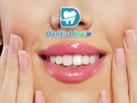 فیسینگ دندان برای لبخند بازیگران؛ راز زیبایی بی‌نقص و اعتماد به نفس