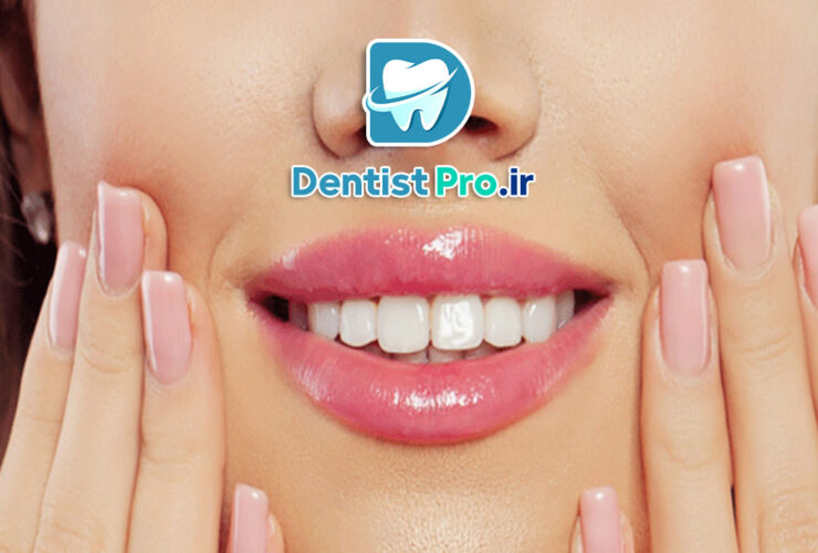 فیسینگ دندان برای لبخند بازیگران؛ راز زیبایی بینقص و اعتماد به نفس 34 فیسینگ دندان برای لبخند بازیگران؛ راز زیبایی بینقص و اعتماد به نفس