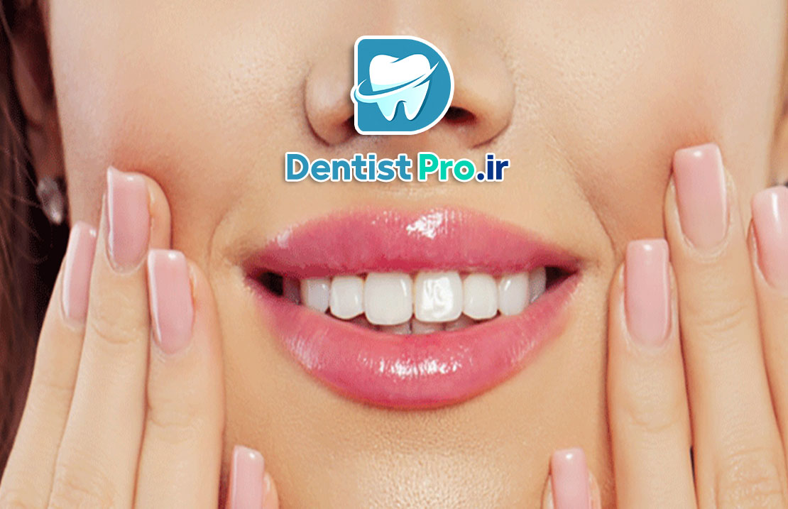 فیسینگ دندان برای لبخند بازیگران؛ راز زیبایی بینقص و اعتماد به نفس 25 فیسینگ دندان برای لبخند بازیگران؛ راز زیبایی بینقص و اعتماد به نفس