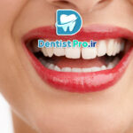 هزینه جراحی لثه؛ بررسی کامل تعرفه‌ها و پارامترهای مؤثر