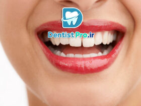 هزینه جراحی لثه؛ بررسی کامل تعرفه‌ها و پارامترهای مؤثر