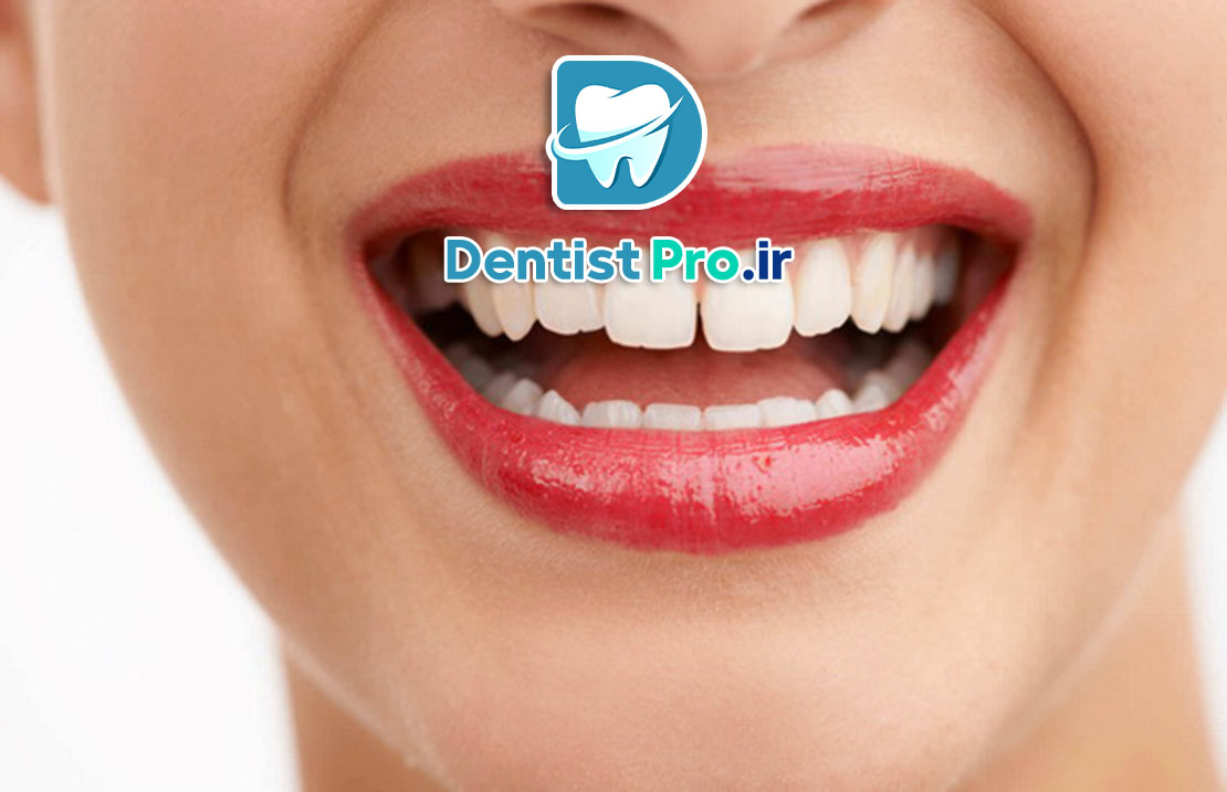 هزینه جراحی لثه؛ بررسی کامل تعرفهها و پارامترهای مؤثر 25 هزینه جراحی لثه؛ بررسی کامل تعرفهها و پارامترهای مؤثر