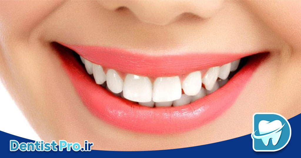 هزینه جراحی لثه؛ بررسی کامل تعرفهها و پارامترهای مؤثر 28 هزینه جراحی لثه؛ بررسی کامل تعرفهها و پارامترهای مؤثر