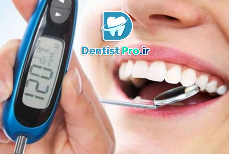 اثر دیابت بر لثه ها: چگونه دیابت سلامت لثه‌ها را تحت تأثیر قرار می‌دهد؟