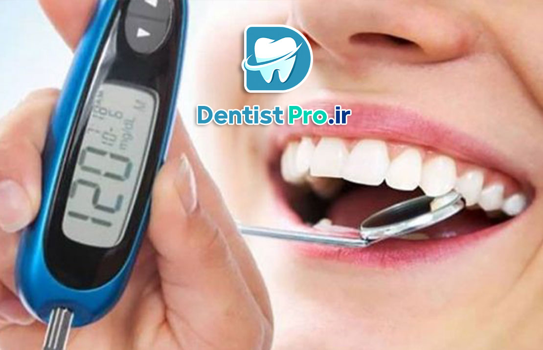 اثر دیابت بر لثه ها: چگونه دیابت سلامت لثه‌ها را تحت تأثیر قرار می‌دهد؟