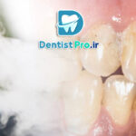 اثر سیگار بر لثه: پیامدهای مصرف سیگار بر سلامت لثه و راهکارهای پیشگیری