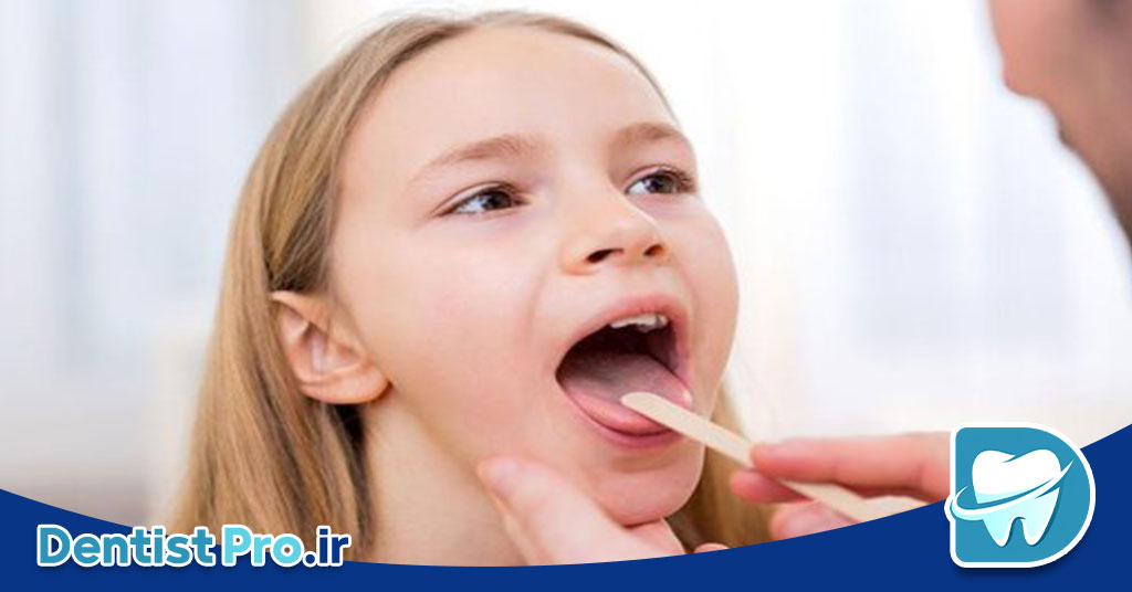 اهمیت زبان در تشخیص بیماری ها سیستمیک در دندانپزشکی 27 اهمیت زبان در تشخیص بیماری ها سیستمیک در دندانپزشکی