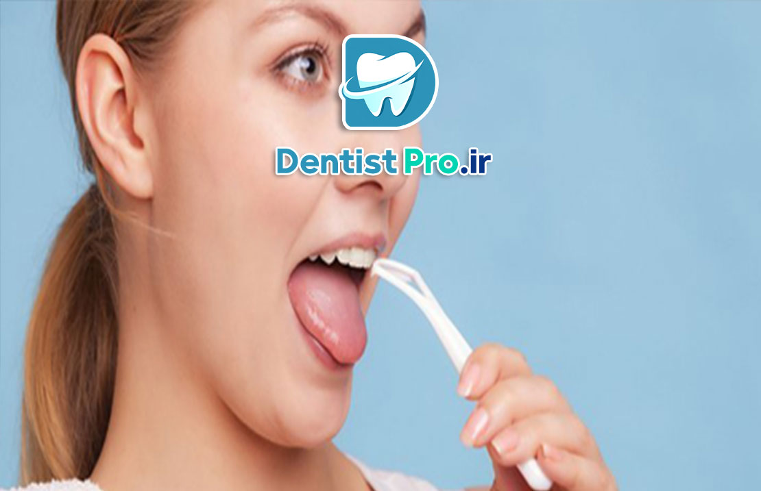 اهمیت زبان در تشخیص بیماری ها سیستمیک در دندانپزشکی 25 اهمیت زبان در تشخیص بیماری ها سیستمیک در دندانپزشکی