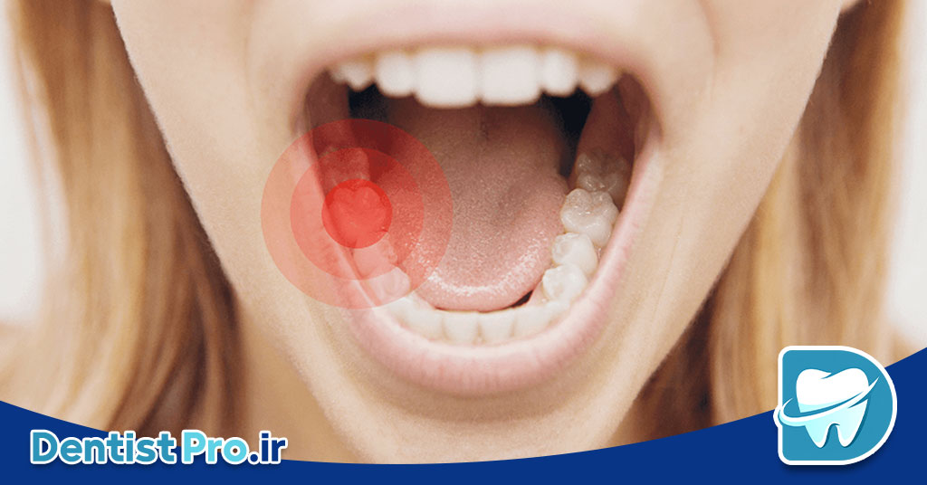درد دندان بعد از پر کردن؛ علل، راهکارها و نکات مهم برای کاهش درد
