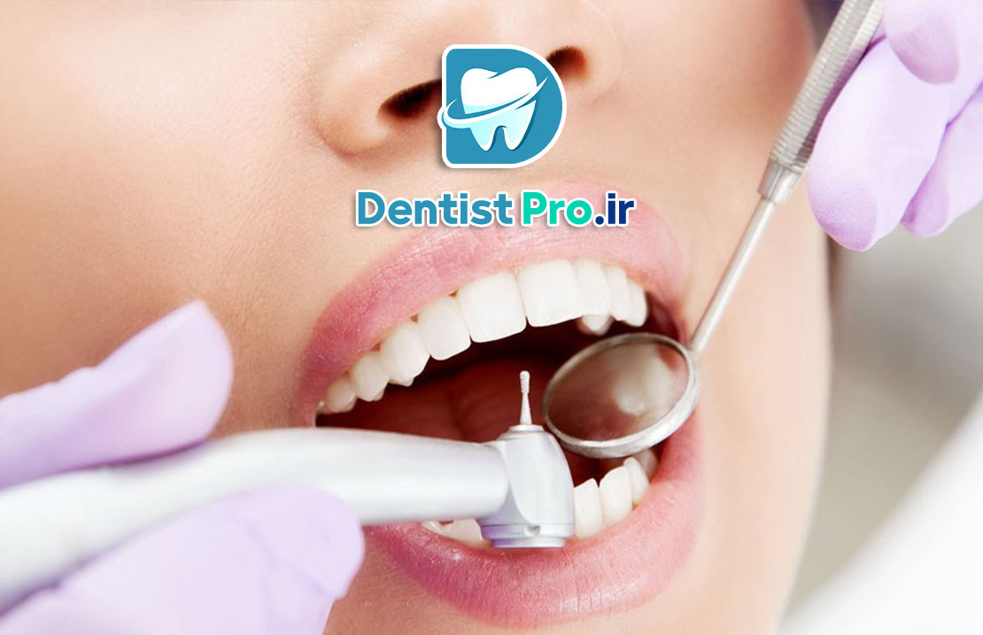 درد دندان بعد از پر کردن؛ علل، راهکارها و نکات مهم برای کاهش درد