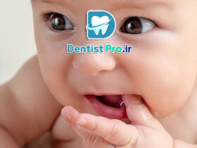 درمان دندان‌درد کودک در خانه: راهنمای کامل والدین