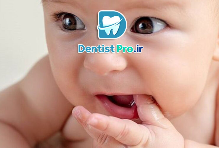 درمان دنداندرد کودک در خانه: راهنمای کامل والدین 41 درمان دنداندرد کودک در خانه: راهنمای کامل والدین