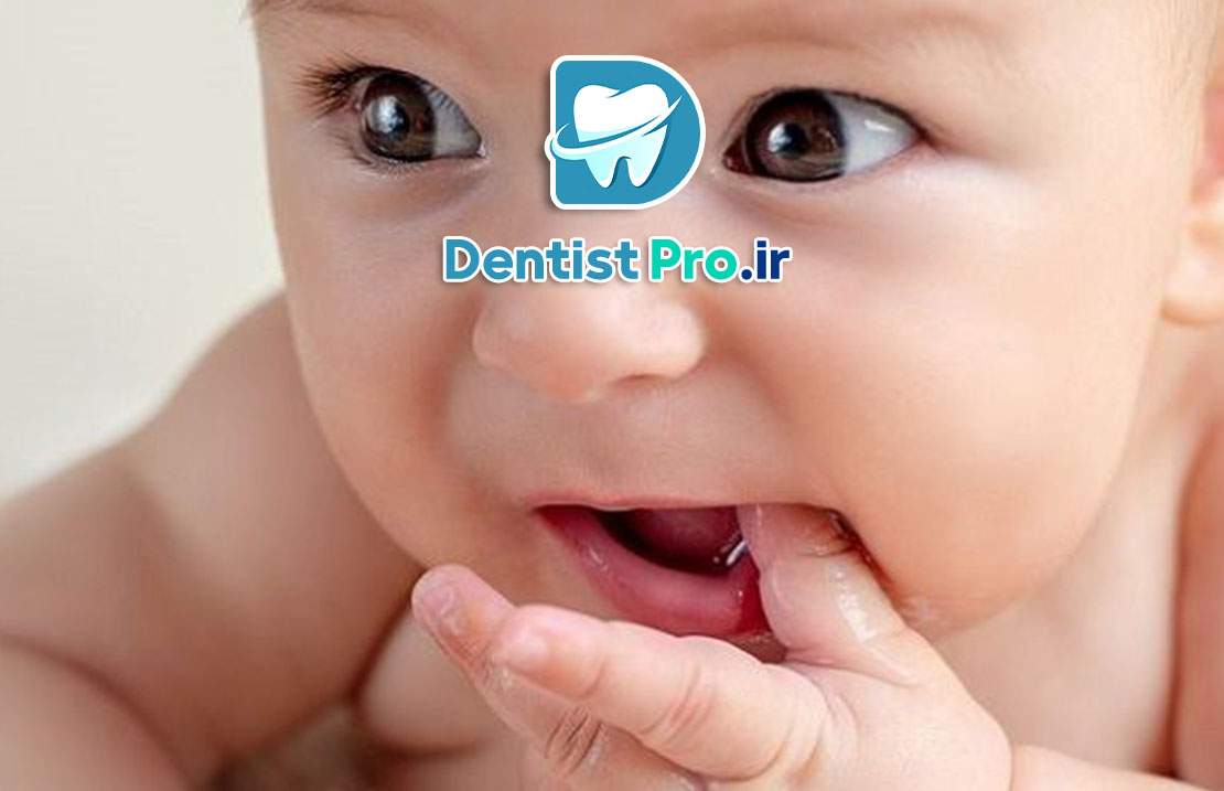 درمان دنداندرد کودک در خانه: راهنمای کامل والدین 25 درمان دنداندرد کودک در خانه: راهنمای کامل والدین