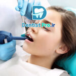 استفاده از سیلانت برای پیشگیری از پوسیدگی؛ روشی مؤثر در حفظ سلامت دندان‌ها