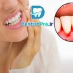 علائم هشداردهنده بیماری لثه+10 علامت هشداردهنده