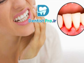علائم هشداردهنده بیماری لثه+10 علامت هشداردهنده