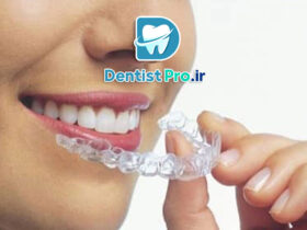 ارتودنسی بدون سیم برای بزرگسالان: راهکاری نوین و محبوب برای اصلاح لبخند