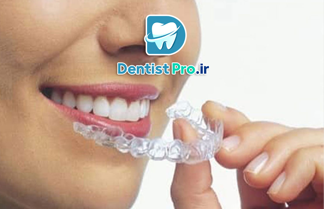 ارتودنسی بدون سیم برای بزرگسالان: راهکاری نوین و محبوب برای اصلاح لبخند 25 ارتودنسی بدون سیم برای بزرگسالان: راهکاری نوین و محبوب برای اصلاح لبخند