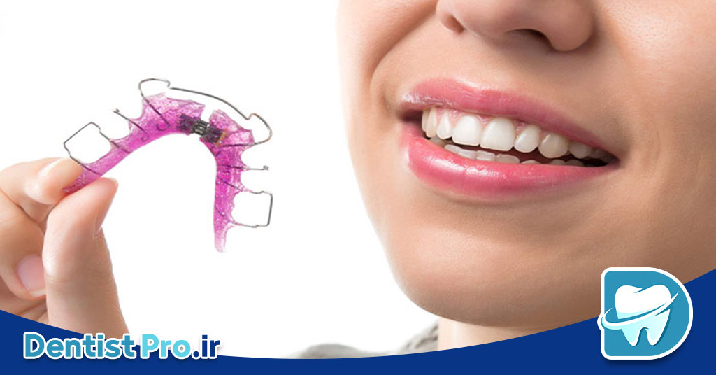 ارتودنسی بدون سیم برای بزرگسالان: راهکاری نوین و محبوب برای اصلاح لبخند 27 ارتودنسی بدون سیم برای بزرگسالان: راهکاری نوین و محبوب برای اصلاح لبخند