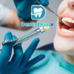 جراحی دندان عقل با بی حسی موضعی؛ راهنمای کامل و کاربردی