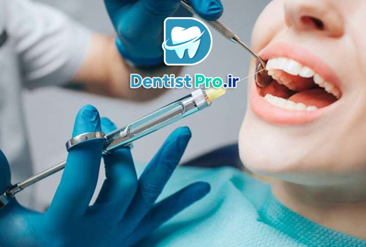 جراحی دندان عقل با بی حسی موضعی؛ راهنمای کامل و کاربردی