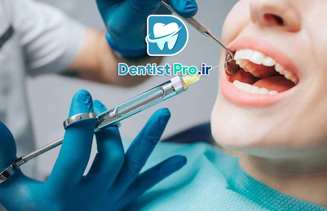 جراحی دندان عقل با بی حسی موضعی؛ راهنمای کامل و کاربردی