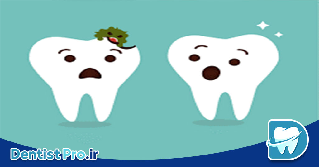 علائم دندان کرم خورده چیست؟