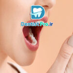 بوی بد زبان: علل، علائم، تشخیص و روش‌های درمان