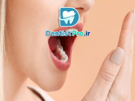 بوی بد زبان: علل، علائم، تشخیص و روش‌های درمان