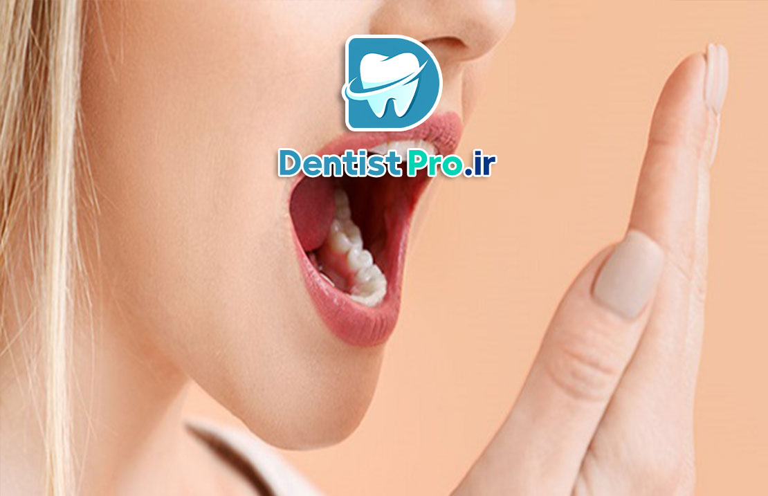 بوی بد زبان: علل، علائم، تشخیص و روش‌های درمان