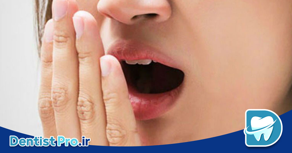 بوی بد زبان: علل، علائم، تشخیص و روش‌های درمان