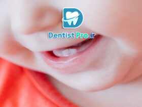 تاثیر شیر شب بر دندان کودک