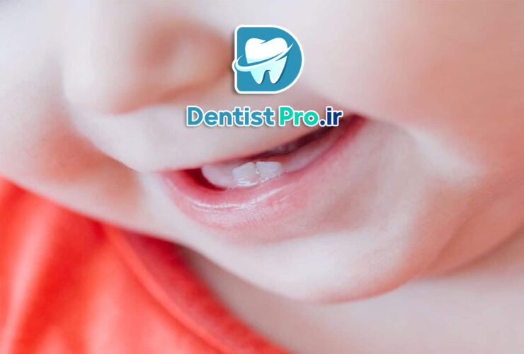تاثیر شیر شب بر دندان کودک 48 تاثیر شیر شب بر دندان کودک