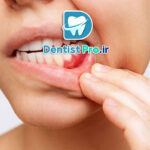 لثه دردناک؛ علل، درمان‌ها و راهکارهای پیشگیری