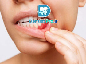 لثه دردناک؛ علل، درمان‌ها و راهکارهای پیشگیری