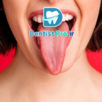 رابطه زبان با سلامت دهان و دندان