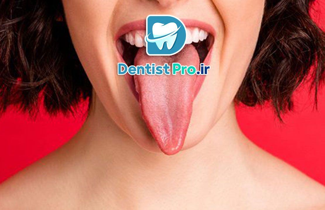 رابطه زبان با سلامت دهان و دندان 25 رابطه زبان با سلامت دهان و دندان