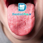 درد زبان: علل، علائم، تشخیص و راه‌های درمان