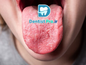 درد زبان: علل، علائم، تشخیص و راه‌های درمان