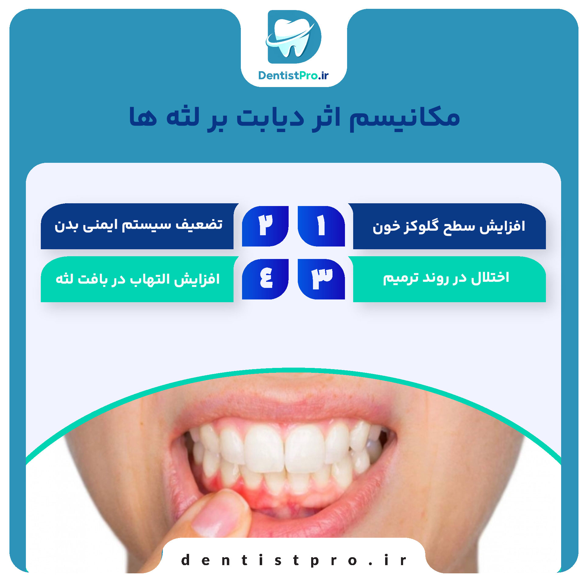 اثر دیابت بر لثه ها: چگونه دیابت سلامت لثه‌ها را تحت تأثیر قرار می‌دهد؟