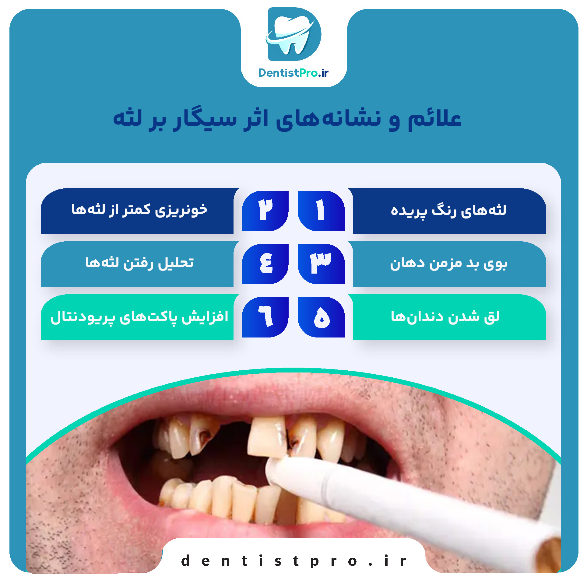 اثر سیگار بر لثه: پیامدهای مصرف سیگار بر سلامت لثه و راهکارهای پیشگیری