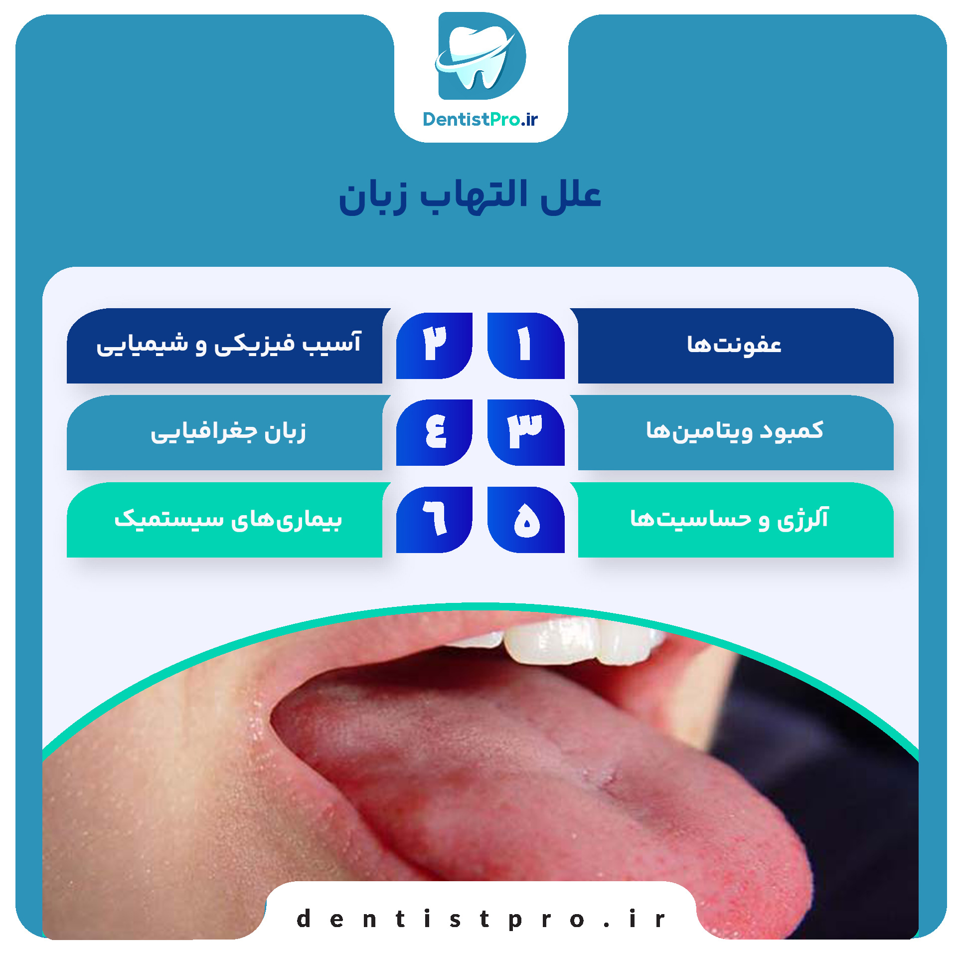 التهاب زبان+ بیماری که باید آن را بشناسید 27 التهاب زبان+ بیماری که باید آن را بشناسید