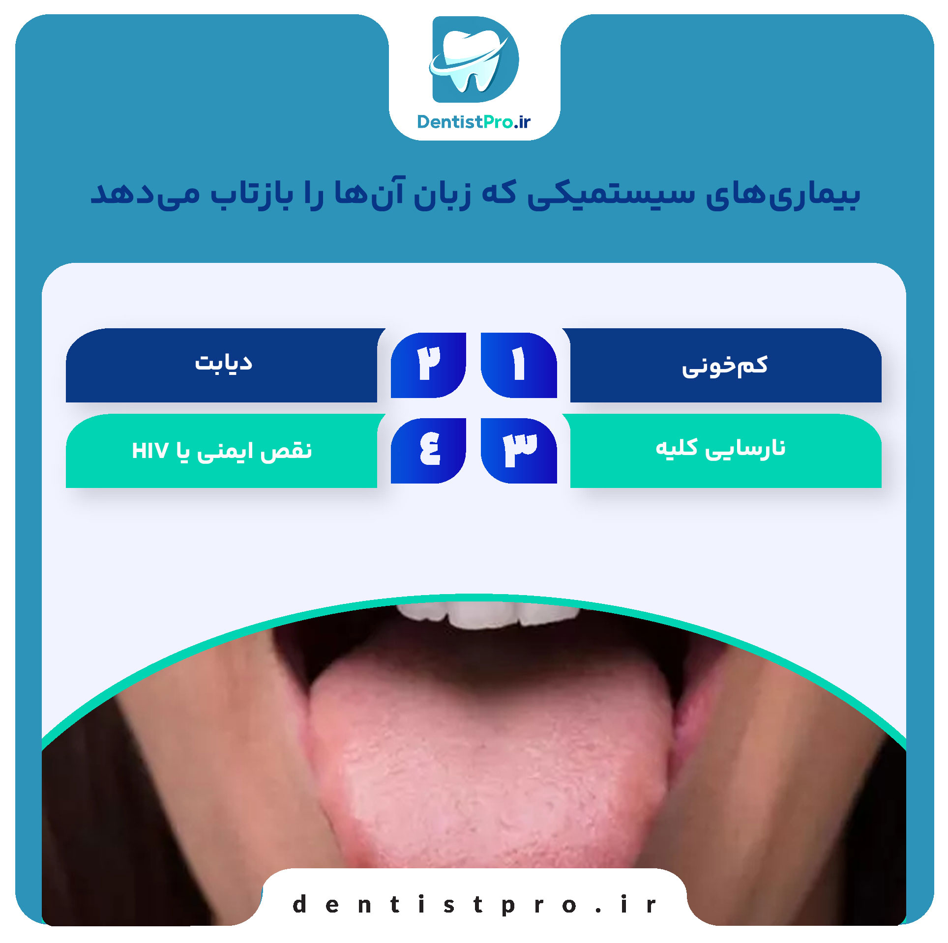 اهمیت زبان در تشخیص بیماری ها سیستمیک در دندانپزشکی 28 اهمیت زبان در تشخیص بیماری ها سیستمیک در دندانپزشکی
