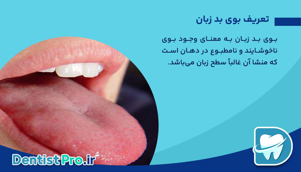 بوی بد زبان: علل، علائم، تشخیص و روش‌های درمان