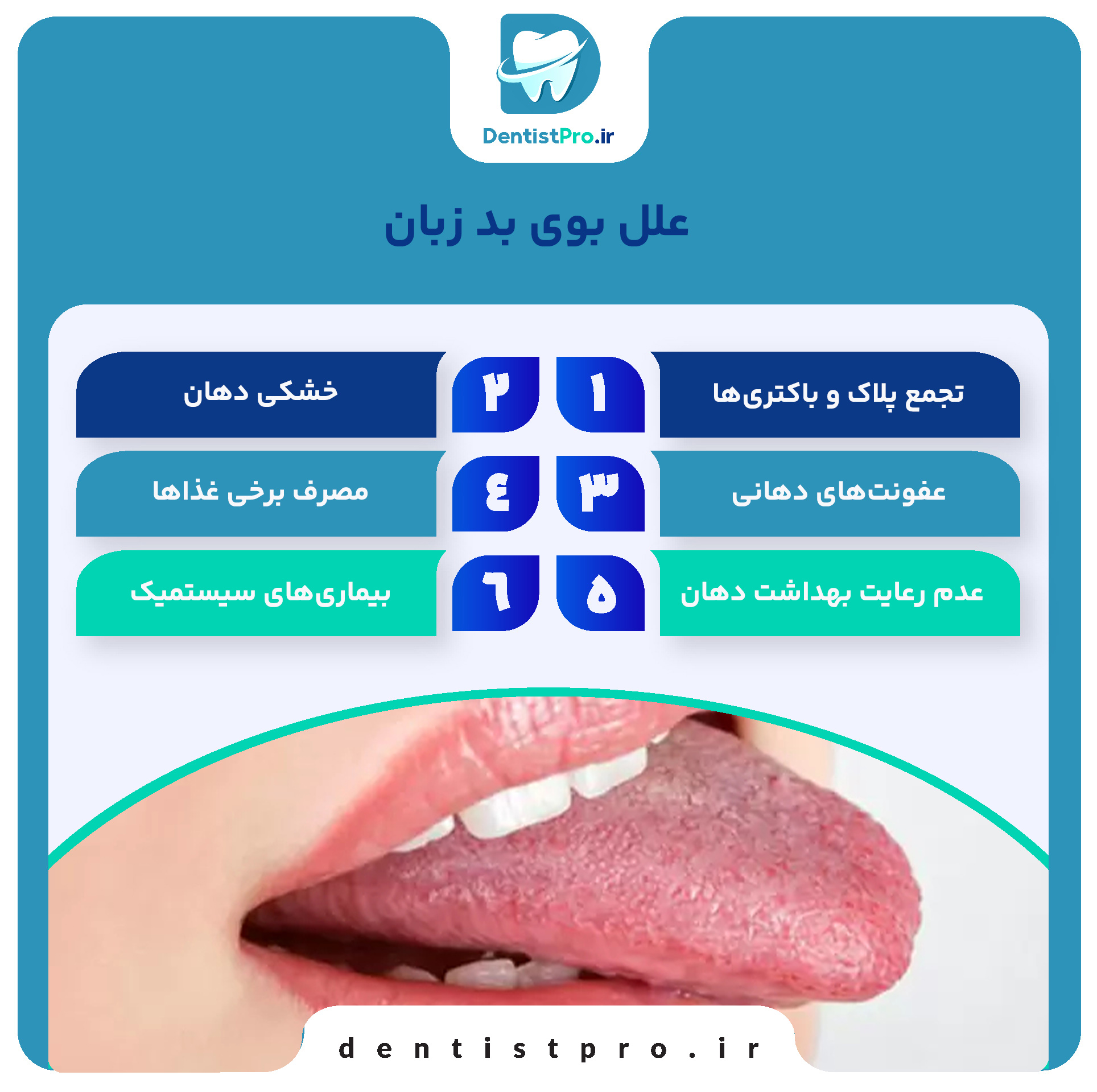 بوی بد زبان: علل، علائم، تشخیص و روش‌های درمان