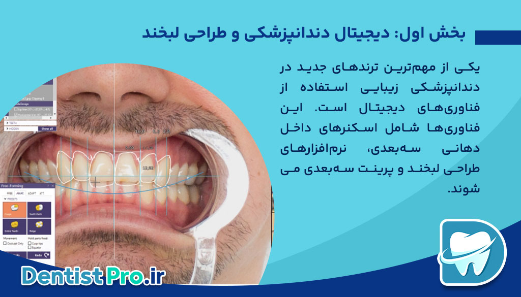 ترندهای جدید در دندانپزشکی زیبایی 26 ترندهای جدید در دندانپزشکی زیبایی