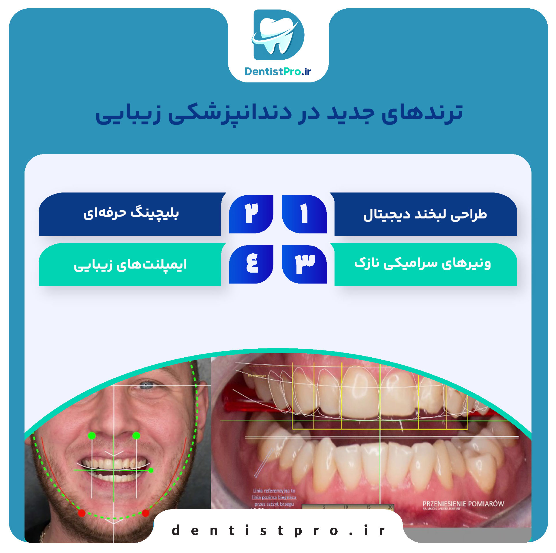 ترندهای جدید در دندانپزشکی زیبایی 27 ترندهای جدید در دندانپزشکی زیبایی