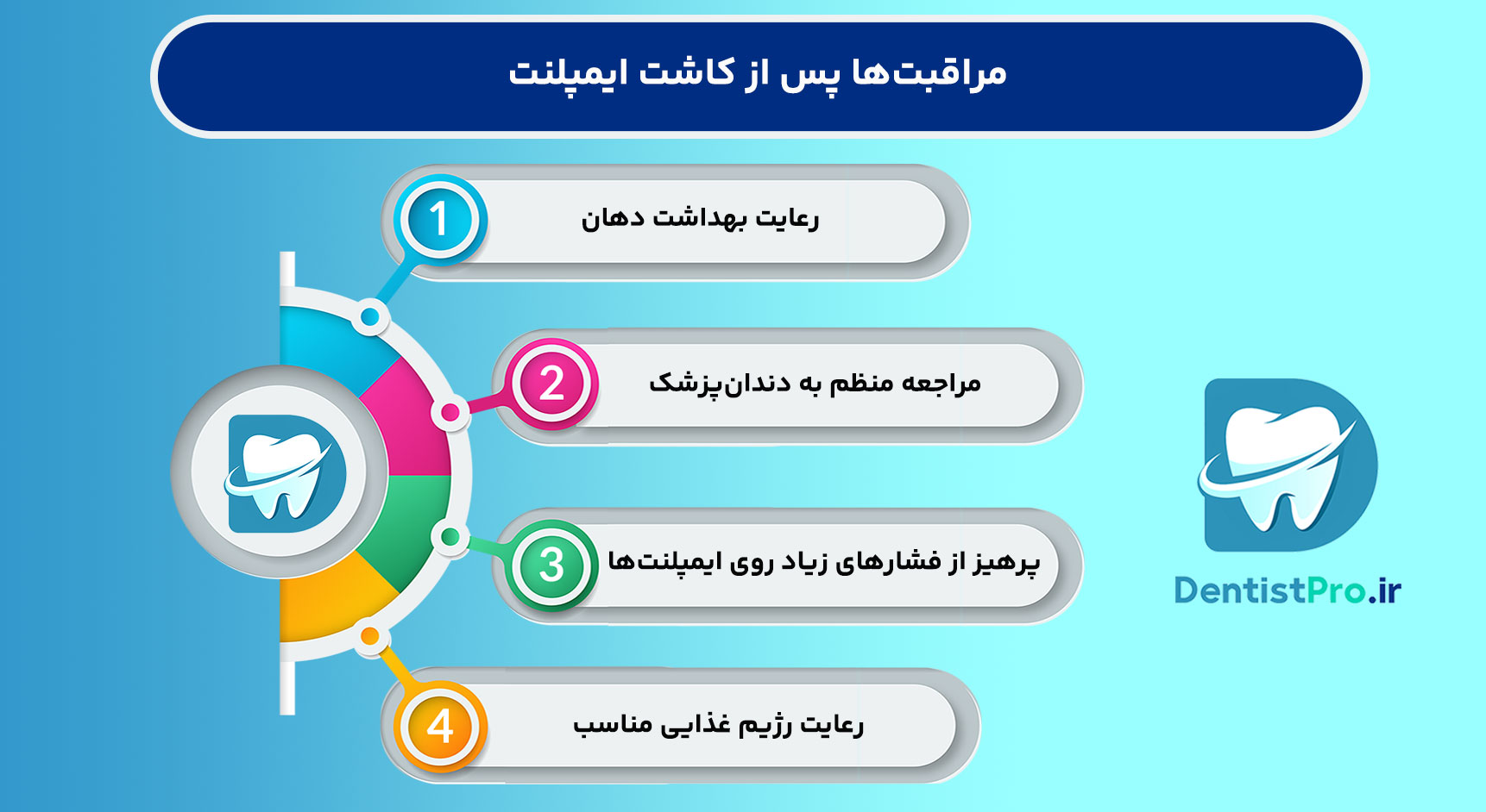 تعداد ایمپلنت برای هر فک چقدر است؟