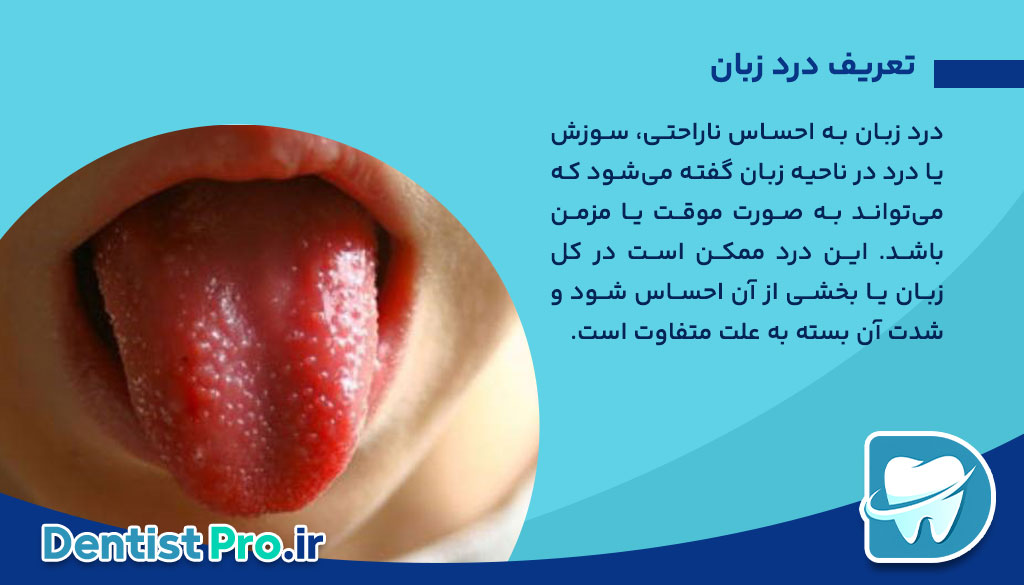 درد زبان: علل، علائم، تشخیص و راههای درمان 26 درد زبان: علل، علائم، تشخیص و راههای درمان